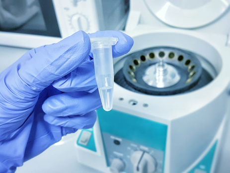 Scientist holding an Eppendorf tube with a sample as part of a DNA extraction procedure.