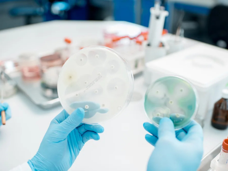 Scientist holding two petri dishes covered with mould
